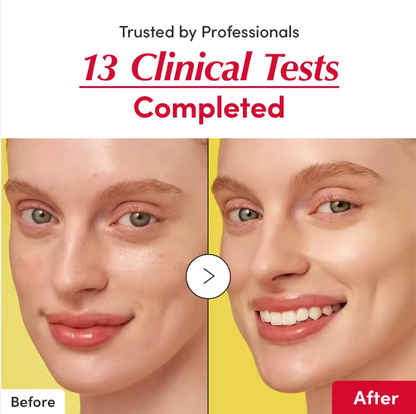 Bakuchiol Essence Serum 30ml